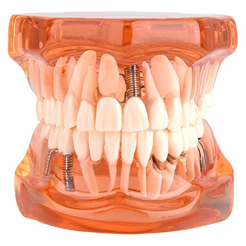 Walfront 1 Pieza Modelo de Dientes, Modelo de Diente de Dientes dentales para la enseñanza de Estudio de demostración de degeneración de Dientes, Naranja